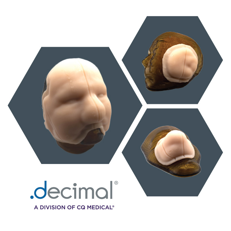 custom bolus pieces for whole face, ear, and nose