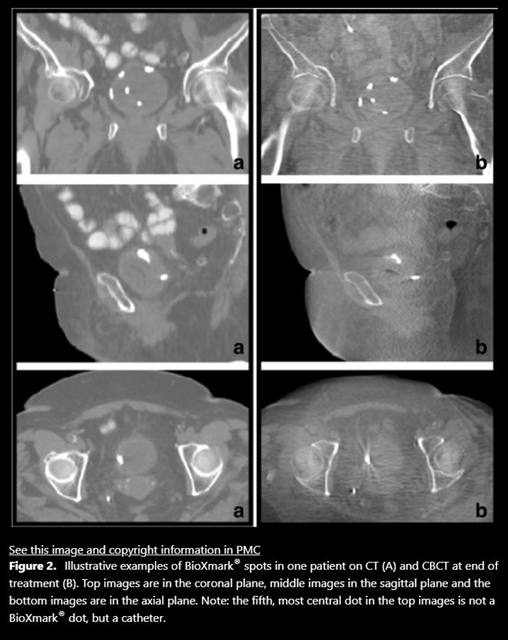BioXmark study image