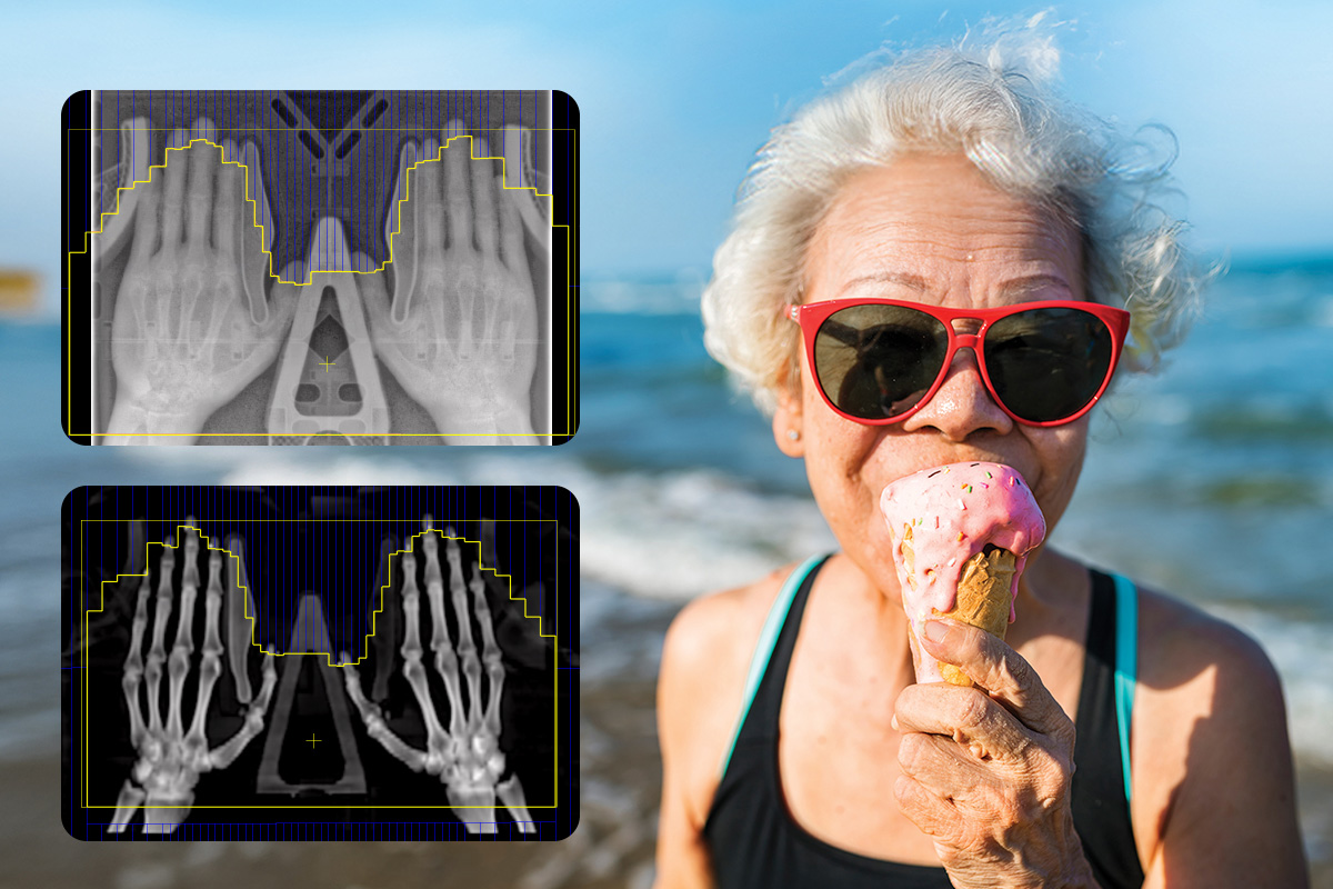 Elderly woman eating ice cream and hand scans for arthritis treatment