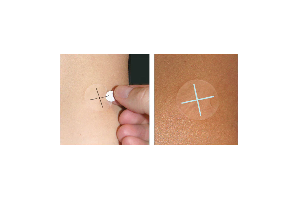 Portal markers on skin