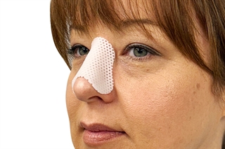 Nasal Splint with patient