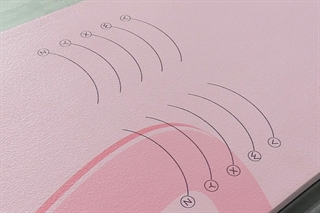 Knee Alignment Marks